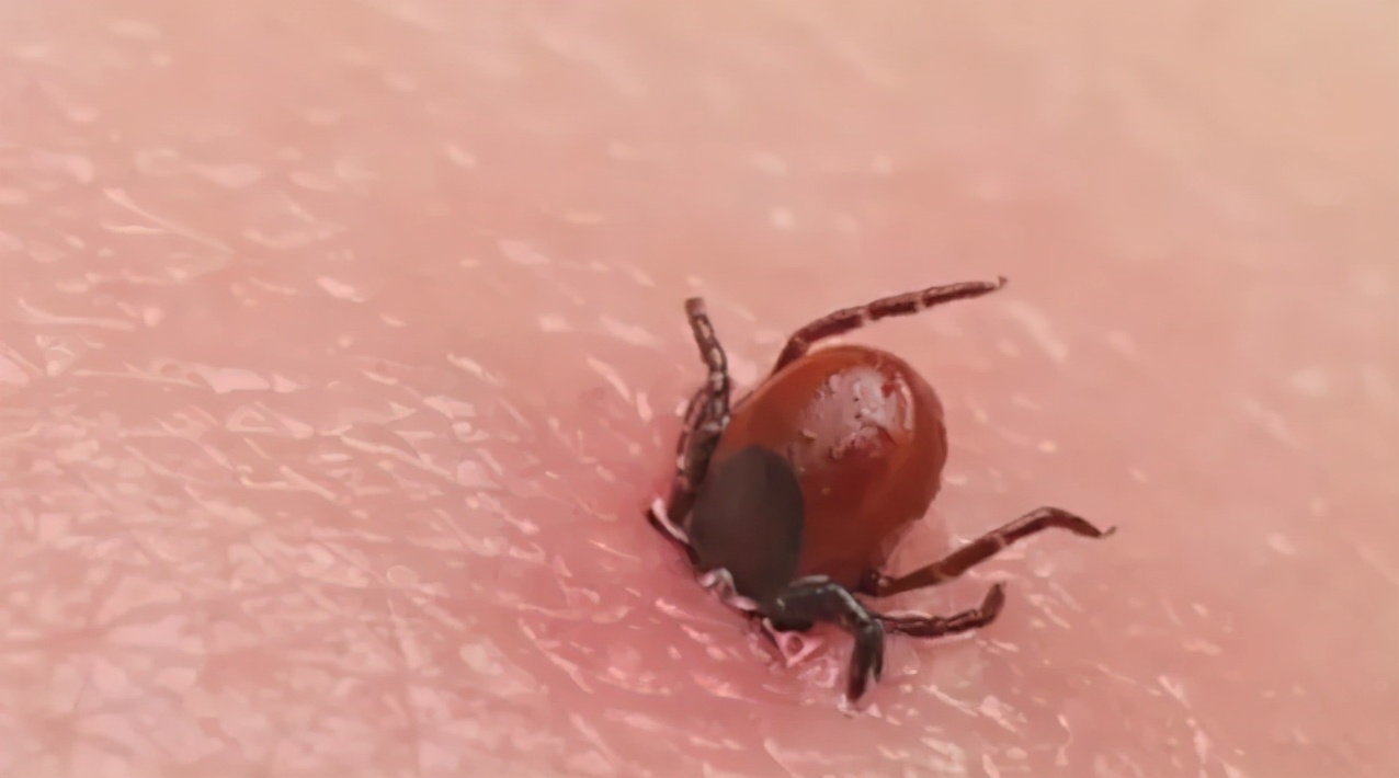 被毒虫咬伤进icu,被虫咬进icu