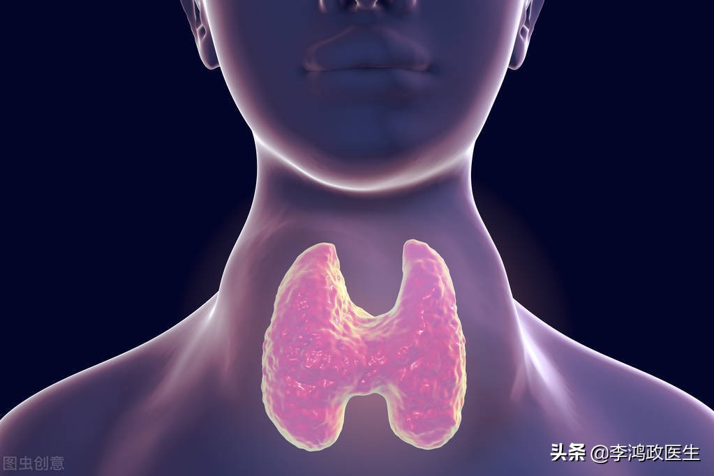 女子发烧用药后咽痛加剧，医生看脖子：不是甲亢，第一次看走眼了