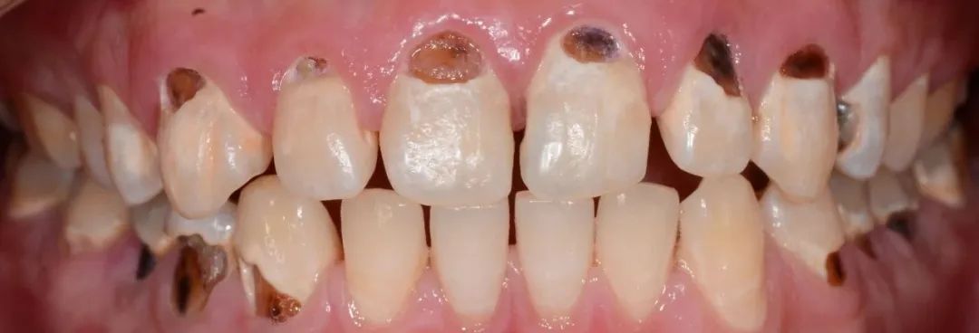 美白牙膏去牙黄真实有效测评,美白牙膏真实测评护牙效果