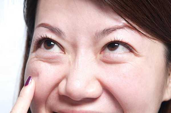 眼袋黑眼圈严重怎么治疗,眼袋黑眼圈怎么治