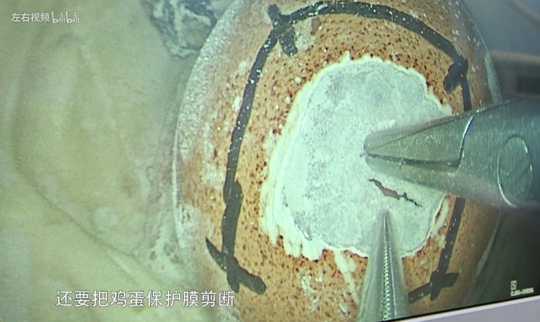 关于医疗纪录片推荐,不煽情却感人