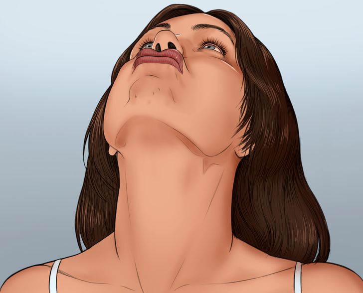 怎么减轻脖子上的皱纹,如何快速去脖子上的皱纹