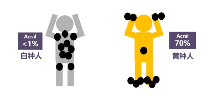 辟谣丨激光点痣不可取,小心“点”出恶性黑色素瘤！5步判断恶性痣