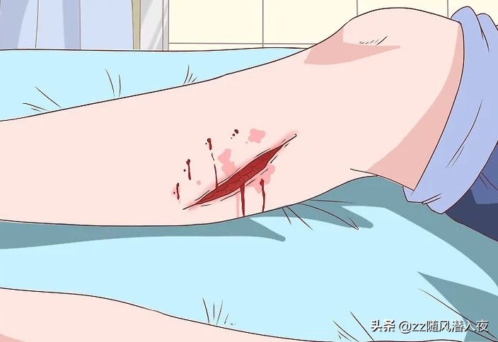 狗咬主人伤口怎么处理,被狗咬了怎么处理狗的伤口