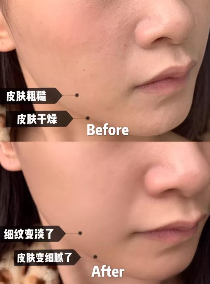 冬季续命神器不止是小暖炉，这10个面霜好用到我想给丁真安利.