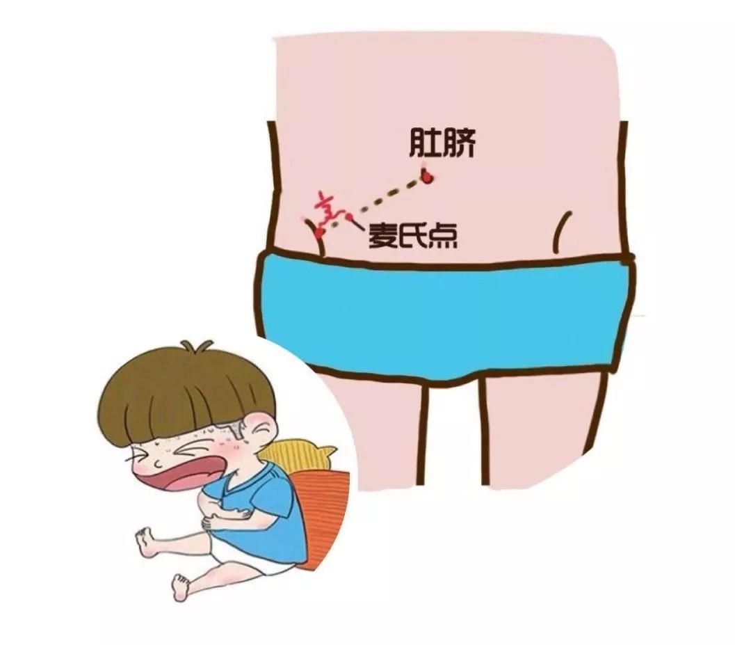 阑尾炎可以不做手术么,阑尾炎可以不做手术吗