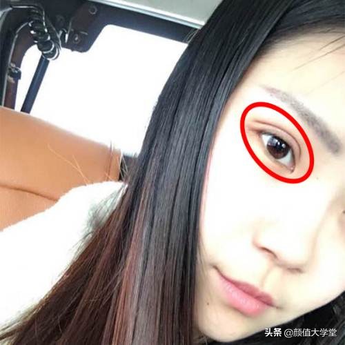 长期贴双眼皮的危害,贴几次双眼皮贴会导致眼皮松弛