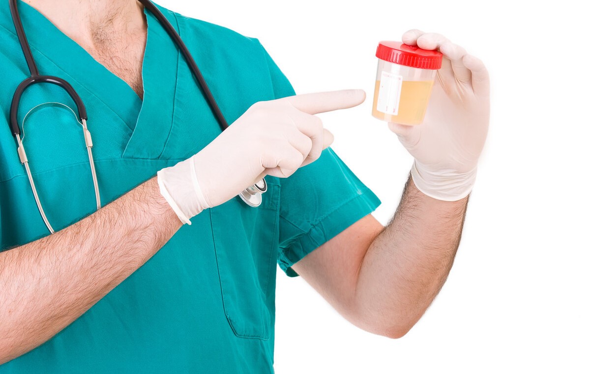 体检出现尿隐血需要复查吗,体检发现尿隐血一个加号