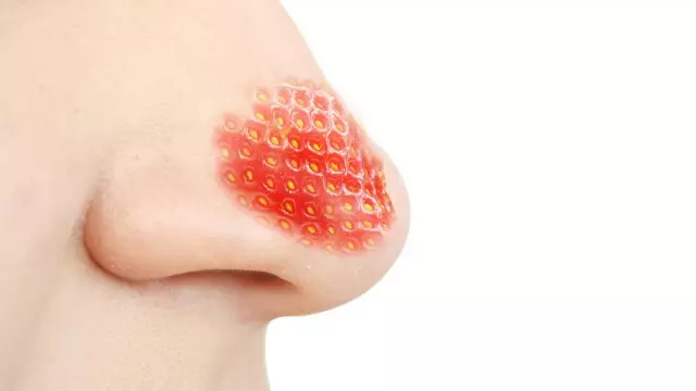 如何去黑头最有效方法,实测有效的去黑头方法