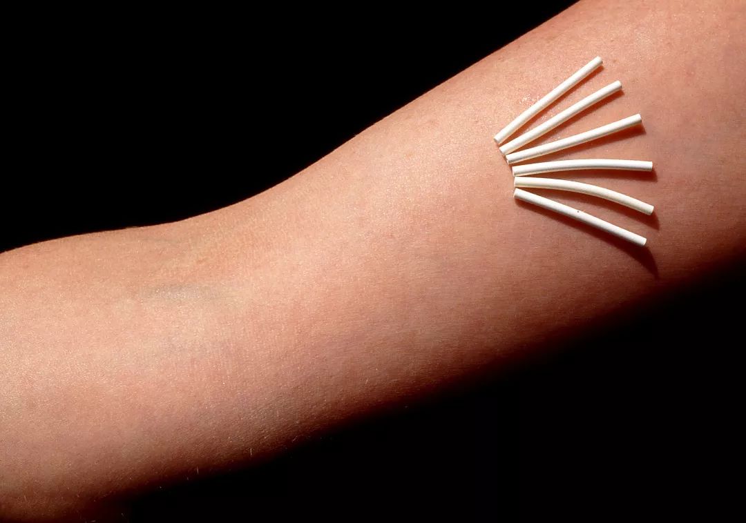 在美国做妇科手术,在美国做什么避孕手术