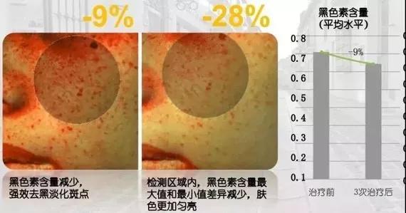 水光针真的比面膜好吗,1次水光等于1000张面膜