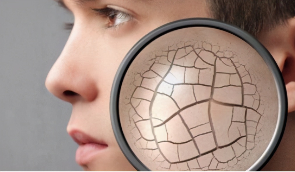 脸上的皮肤干燥皱纹多怎么办,脸上皮肤干燥怎么办快速解决方法