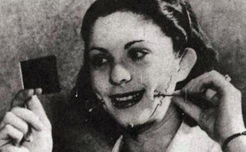 人造酒窝值得做吗,人造酒窝能坚持几年