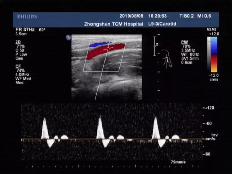 肩臂痛怎么治疗,肩臂痛什么原因