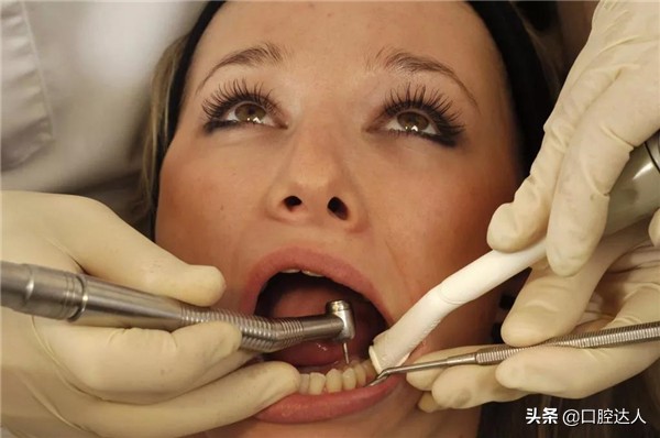 后牙选什么材料补牙,补牙材料太多啦感觉牙不舒服