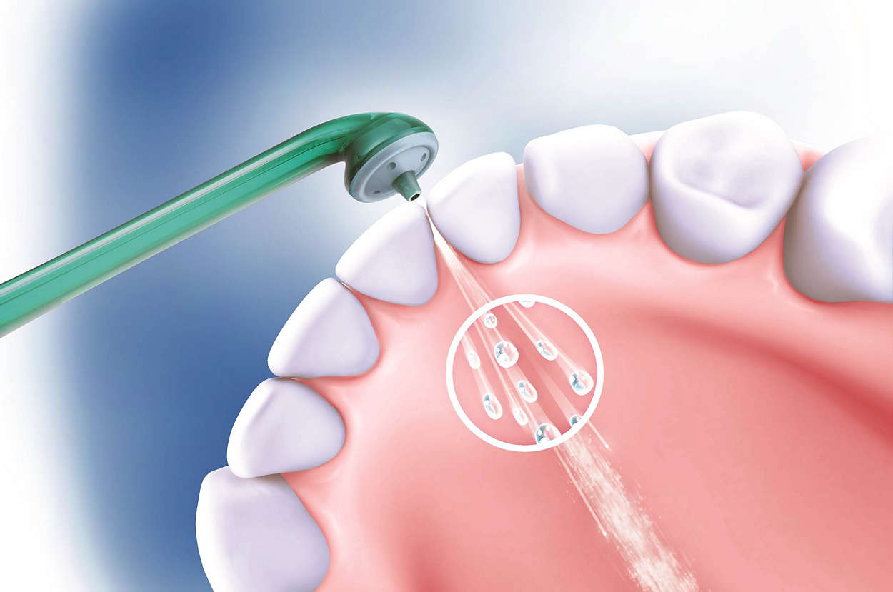 电动牙刷推荐欧乐比飞利浦,有牙刷还要买冲牙器吗