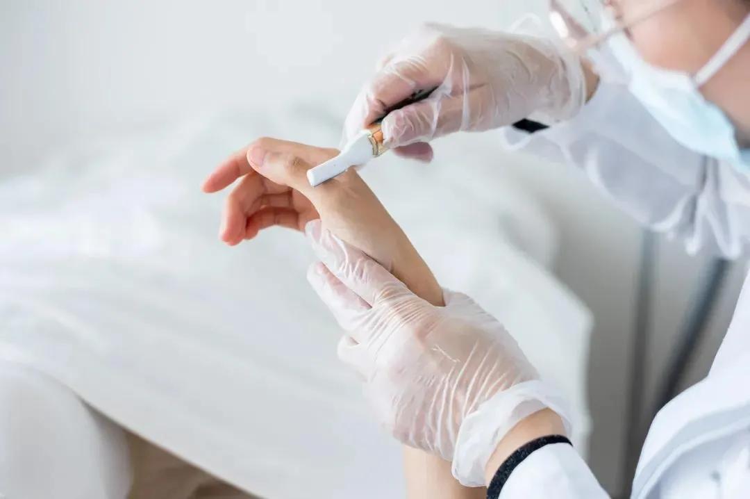 猕猴桃夏日脱毛,猕猴桃女孩轻松脱毛的救星