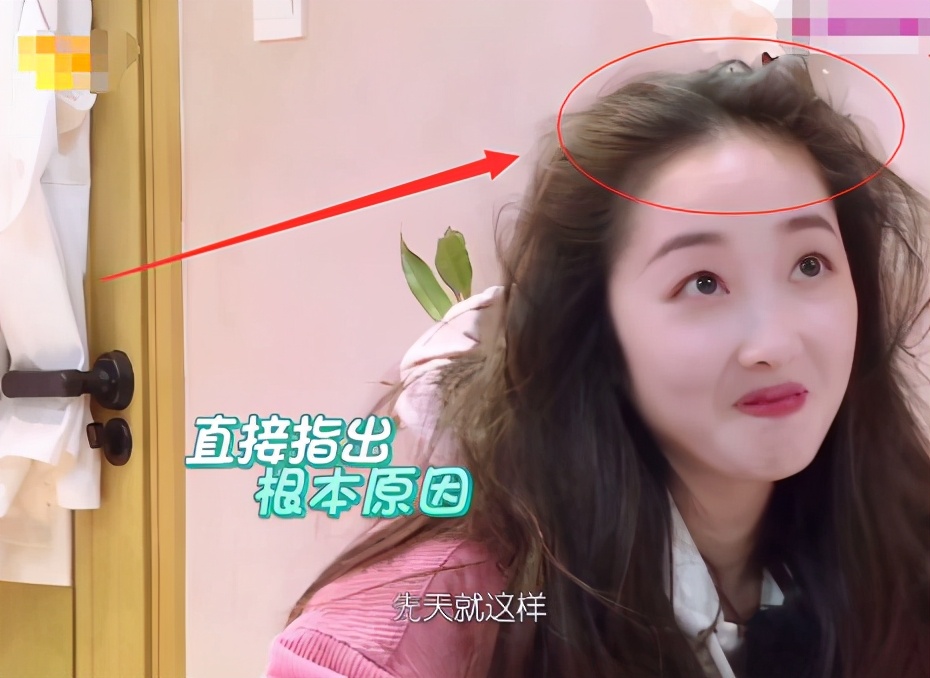 蒋梦婕秃头,蒋梦婕综艺看头发