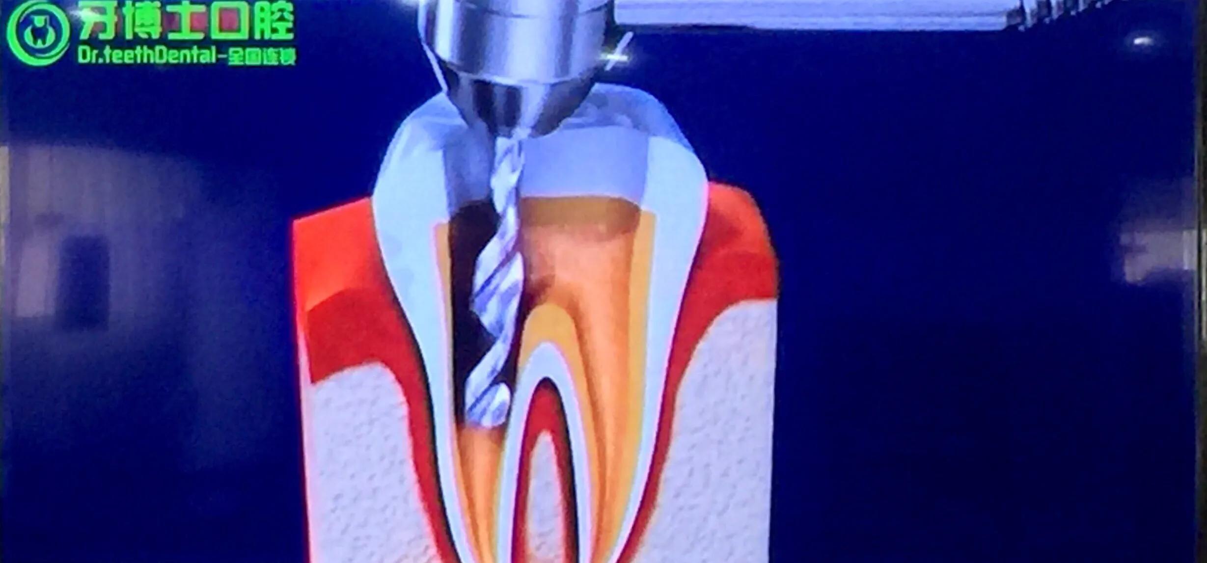 拔牙也是一件痛苦的事,拔牙真的那么恐怖吗