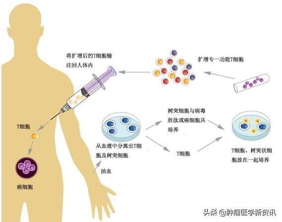 免疫疗法对癌症的治愈率,免疫疗法能彻底治愈癌症吗