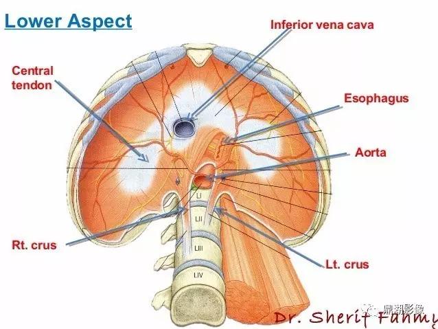 颈部胸锁乳突肌ct断层解剖图,骨盆骨质正常断层ct解剖图解
