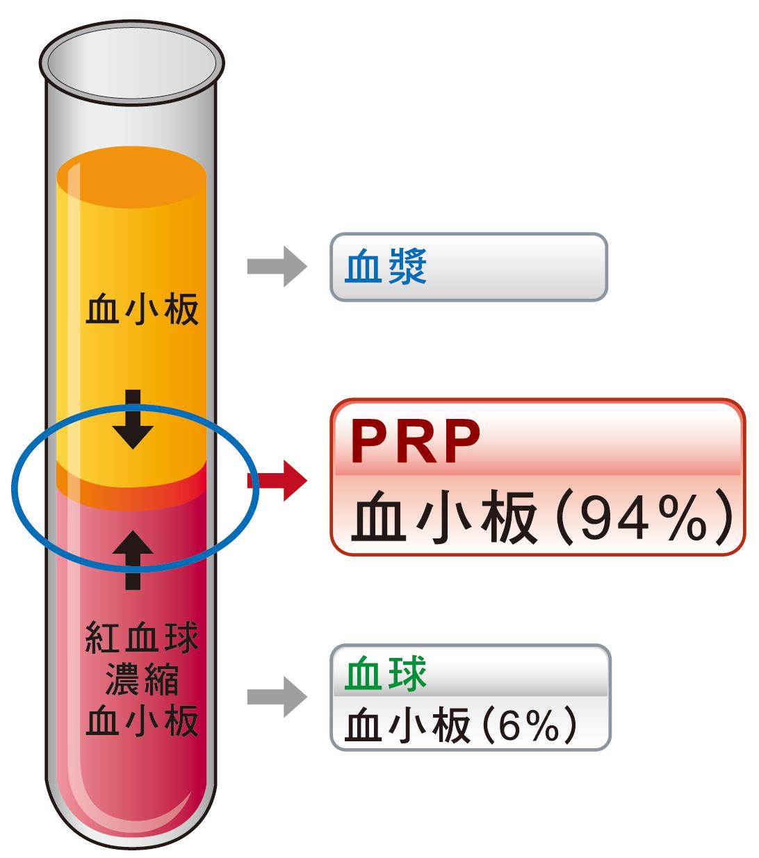 软骨损伤膝关节炎最好治疗方法,膝关节骨性关节炎修补