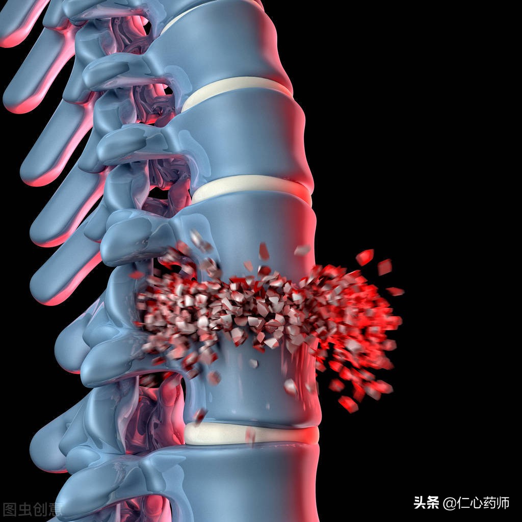 颈椎椎间盘突出的建议,椎间盘突出不建议推拿