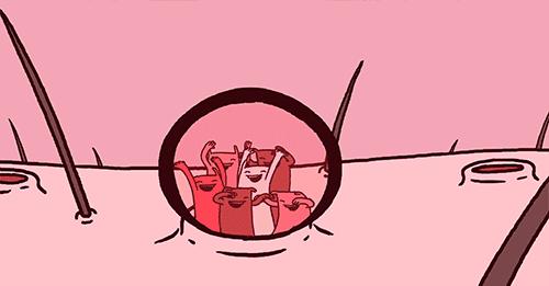 挤不出来的粉刺是什么,挤不出来的闭口自己能消失么