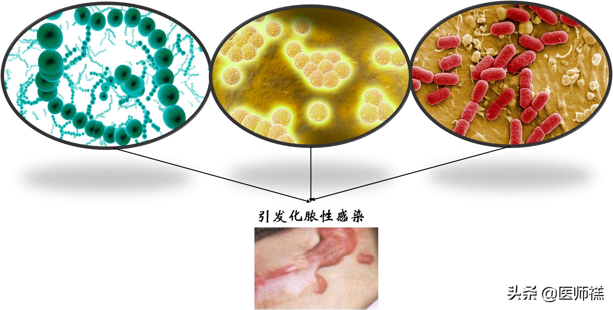 延时湿巾靠不靠谱,会带来哪些健康损害?医生提醒需要警惕这些