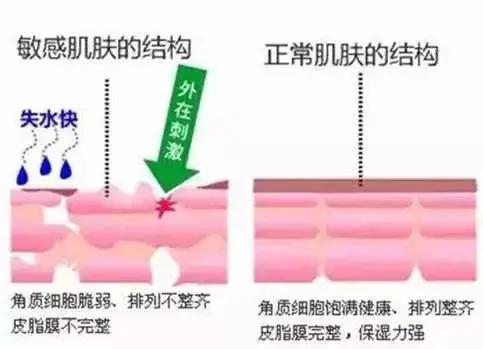 t区出油是什么肤质两颊起皮,冬天鼻子两颊起皮是什么肤质