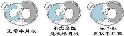 结束运动生涯,结束体育生涯