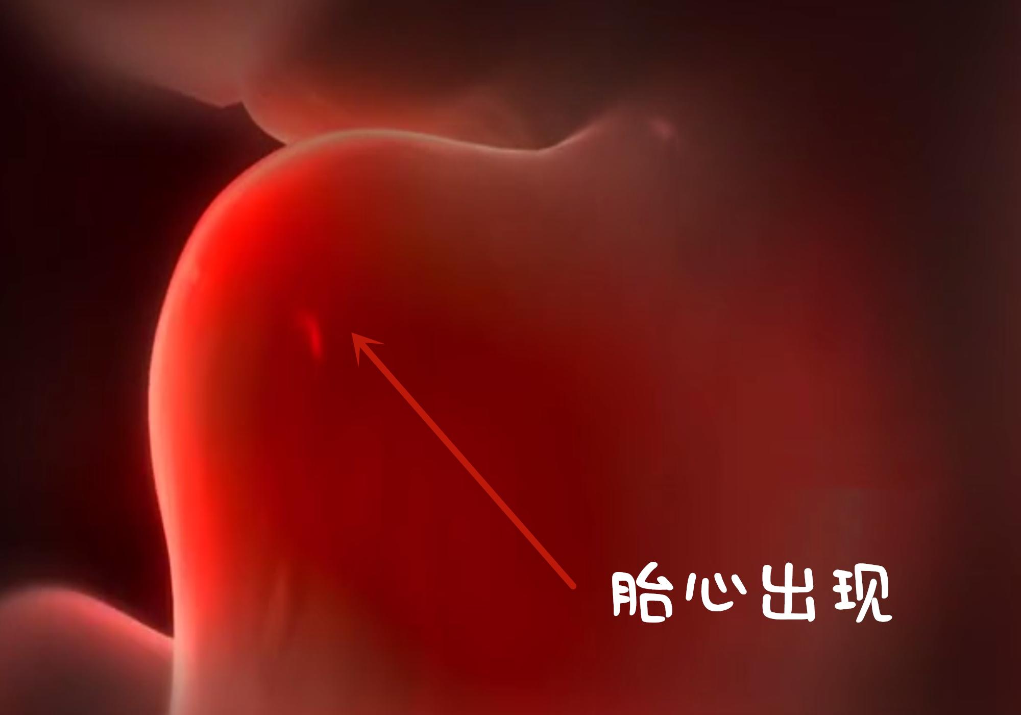 胎心发育全过程高清图,3胞胎孕囊胚胎的发育全过程视频