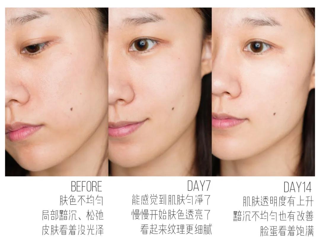 最好用的水乳霜精华是哪一款,最值得购买的护肤单品面霜油皮