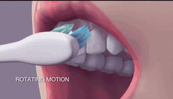 修复缺牙的最好方法,告别“老掉牙”看清这些招