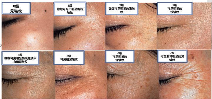 雅诗兰黛15毫升小棕瓶,雅诗兰黛小棕瓶精华100ml日上540元