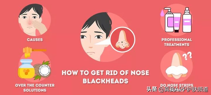 顽固黑头怎么去除最有效,变美小知识黑头怎么去掉