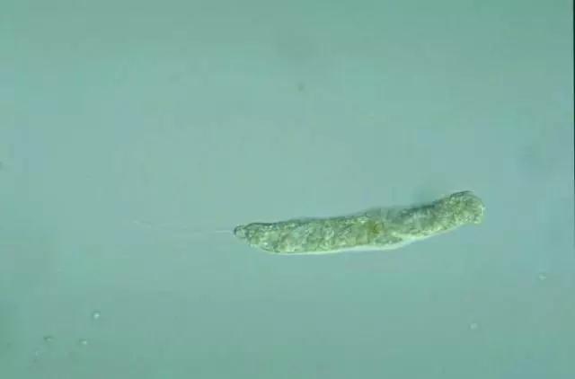 收藏!24种污水处理微生物菌相及指导意义,环保人必看(多图)