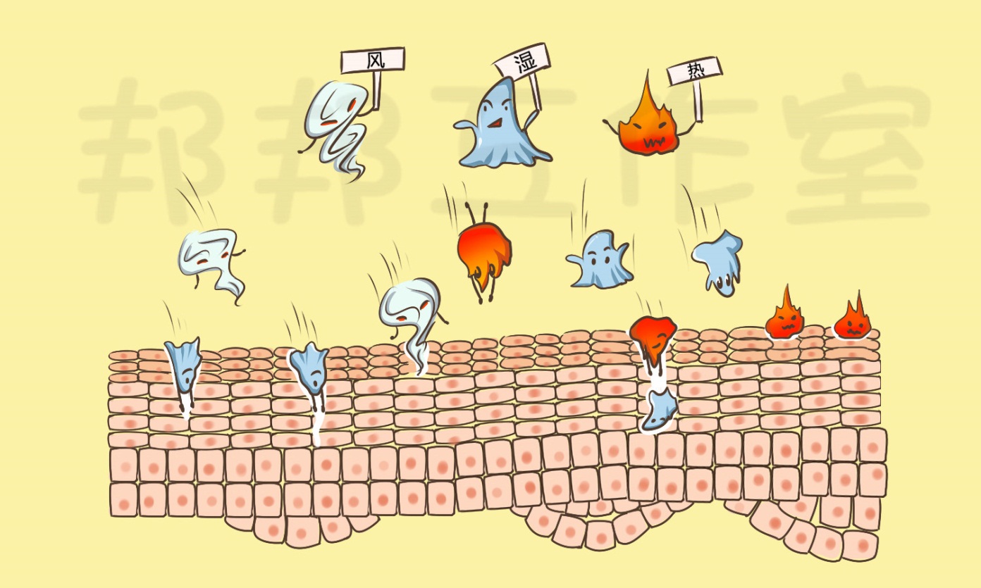 湿疹是由湿气重引起的吗,湿疹是体内湿气太重还是什么原因