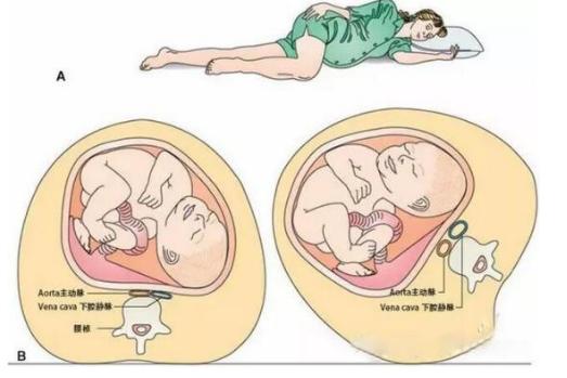孕妇睡觉姿势最佳图片,32周以后孕妇睡觉姿势