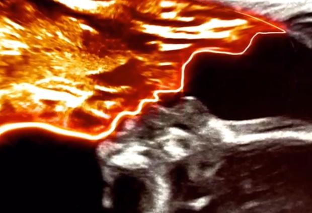 外国孕妇做b超被吓坏,国外孕妇生双胞胎检查结果图片