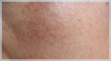 ​真是个“斑”脚石！（上集）