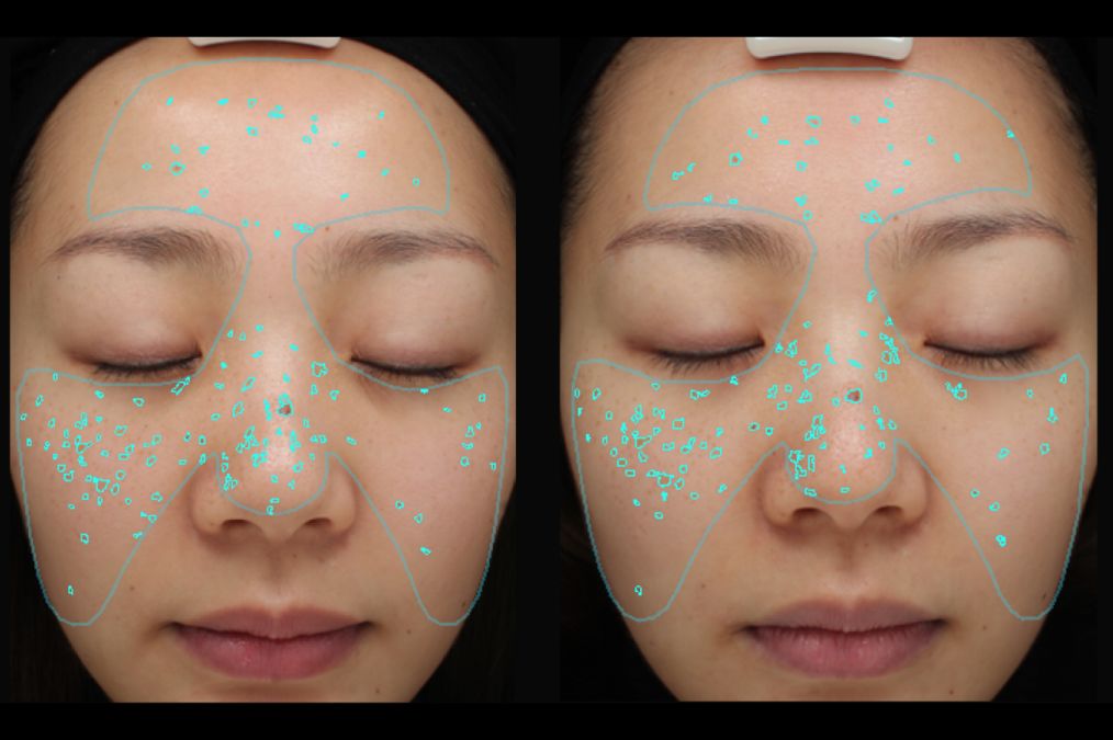 小茂医生美白护肤品,小茂教你如何护肤