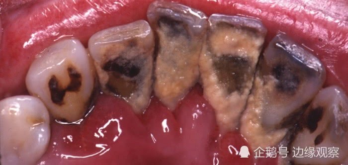 韩国香烟铁盒装,韩国香烟脸谱