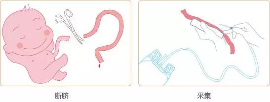 可以“救命”的脐带血，到底存还是不存？