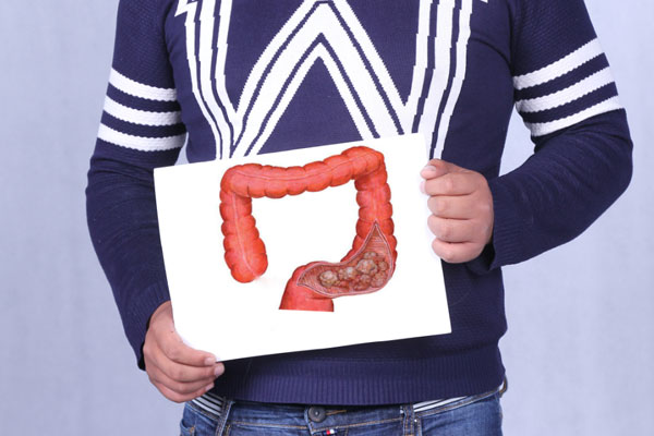 肠息肉是怎么形成的要注意什么,肠息肉是怎样形成的怎么治疗