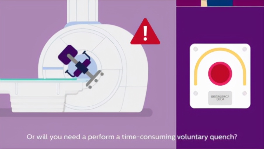 飞利浦3.0核磁共振扫描技术,飞利浦3.0磁共振简介
