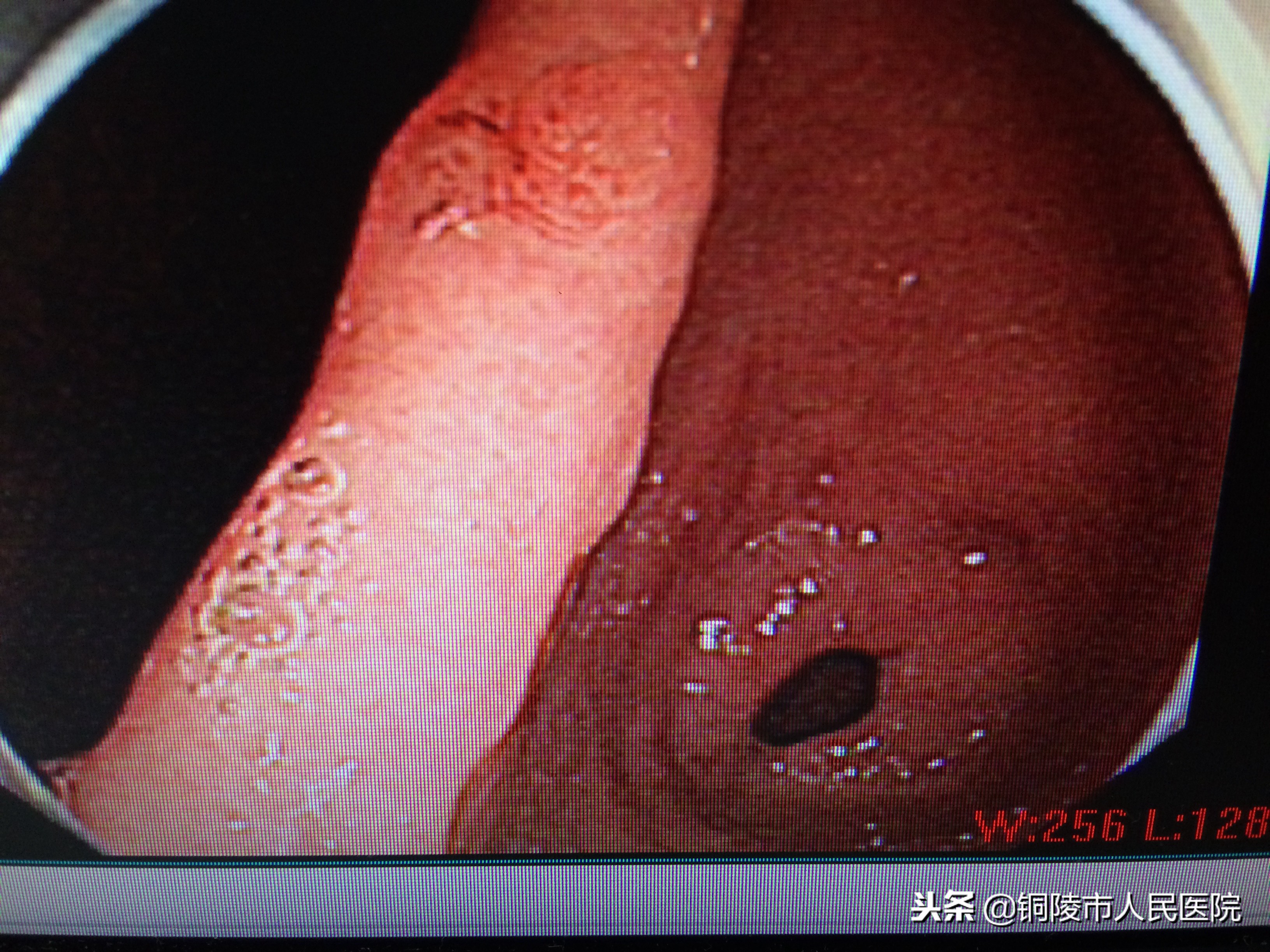 内镜行业的发展趋势,内镜目前发展现状