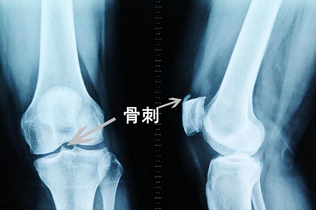 医生忠告六种疾病压根无法治愈,医学上能够治愈的疾病不超过十种