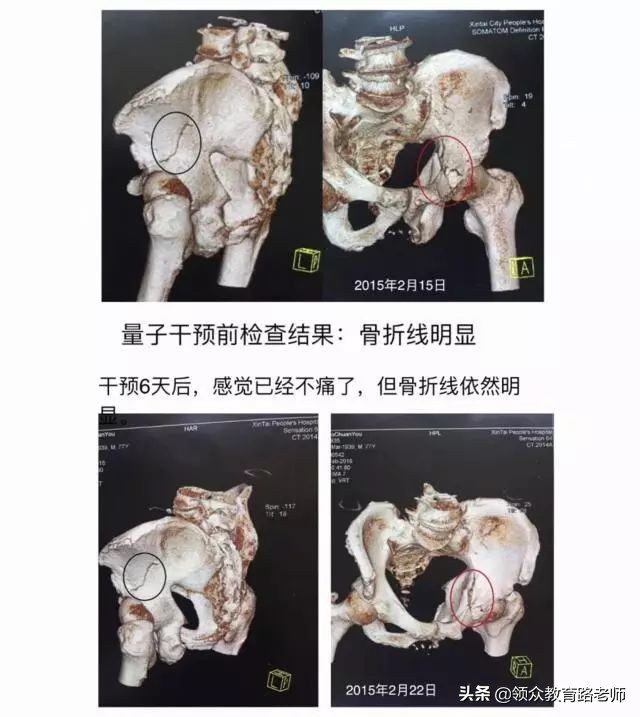 物理实在学不会可以放弃吗,物理想学却学不进怎么办