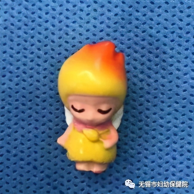 「一线医事」SOS!熊孩子把玩具塞进屁屁